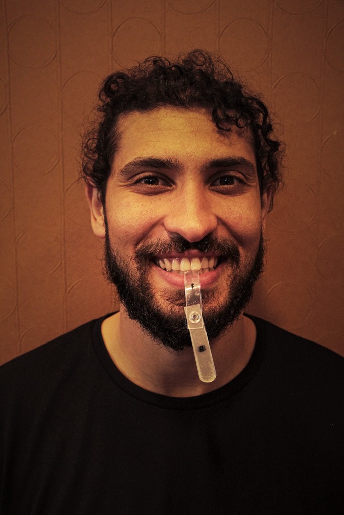 Full Mouth Reconstruction 12-19.09.2021