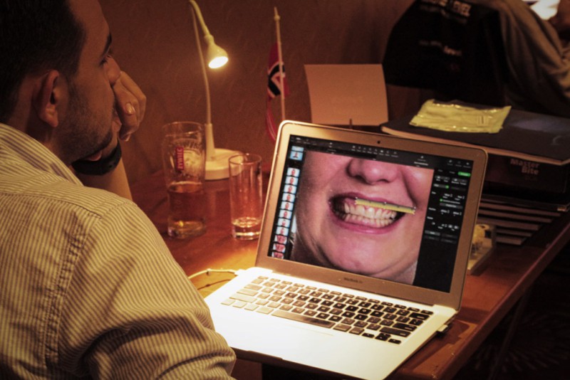 Full Mouth Reconstruction 12-19.09.2021