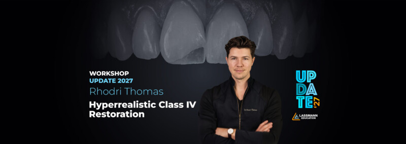 Hyperrealistic Class IV Restoration – Update Workshop