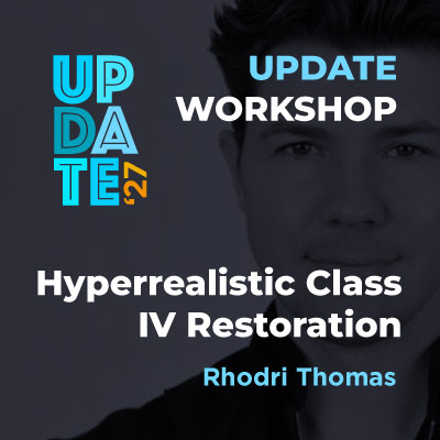 Hyperrealistic Class IV Restoration – Update Workshop