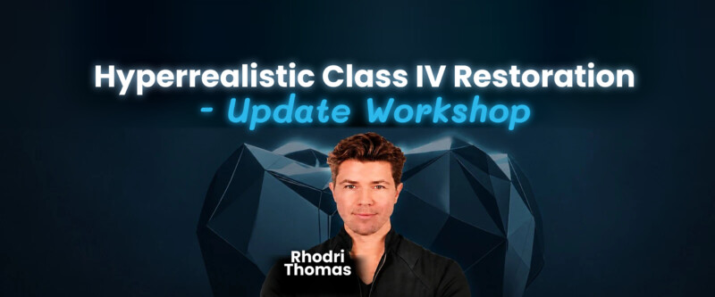Hyperrealistic Class IV Restoration – Update Workshop